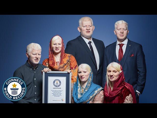 We're Asian, Albino and Beautiful - Guinness World Records