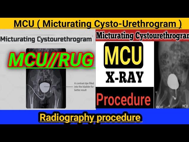 MCU ( Micturating Cysto-Urethrogram ) / x-ray RGU and MCU / MCU test in Hindi #radiography #2023