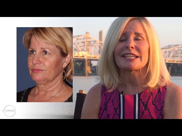 FACELIFT - NECKLIFT - Why DId You Choose Dr. O'Daniel?