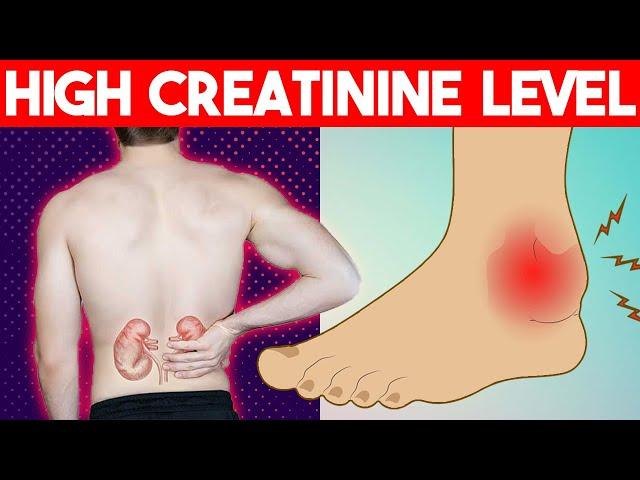 High Creatinine Levels: Common Symptoms and Causes of High creatinine levels you should know