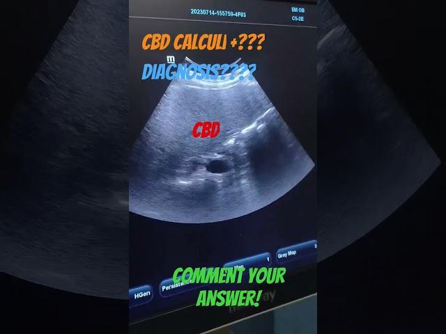 comment your answer?