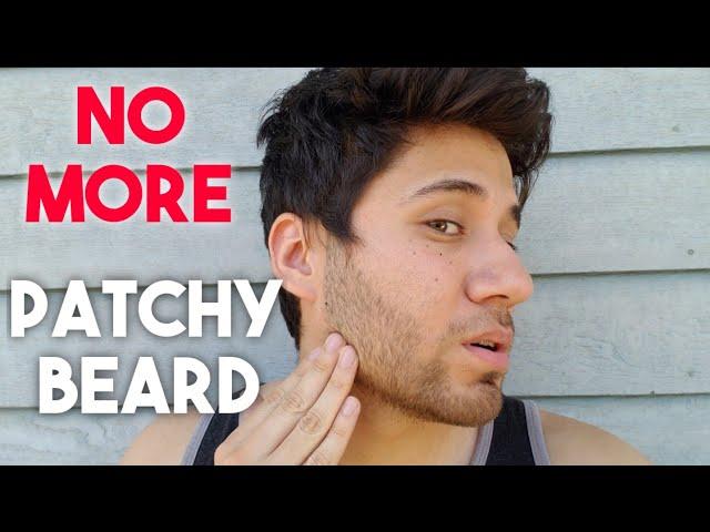 No More Patches In My Beard