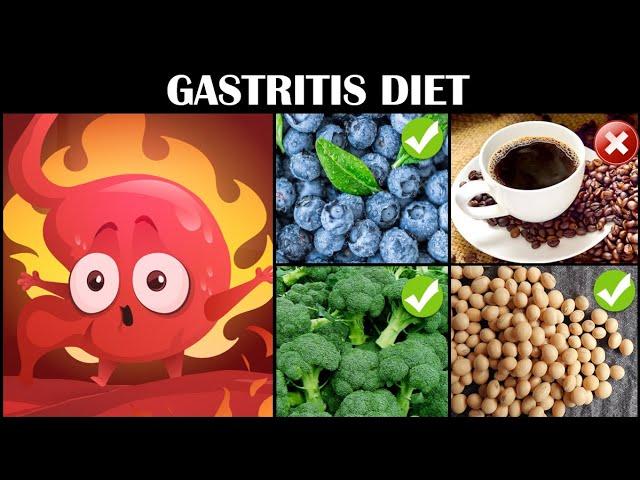 Gastritis Diet - Best & Worst Foods For Gastritis