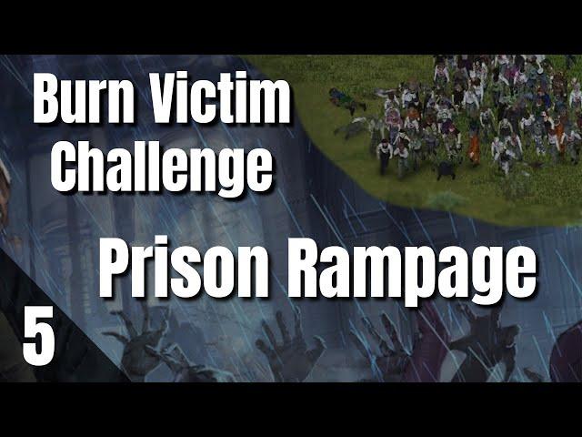 PZ Burn Victim Challenge 2: Finale!