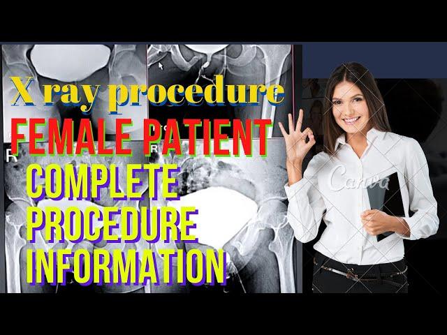 x ray mcu procedure | mcu female procedure | mcu x ray procedure in hindi | MCU radiology #trending