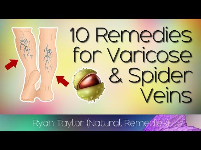 10 Natural Treatments for Varicose Veins & Spider Veins