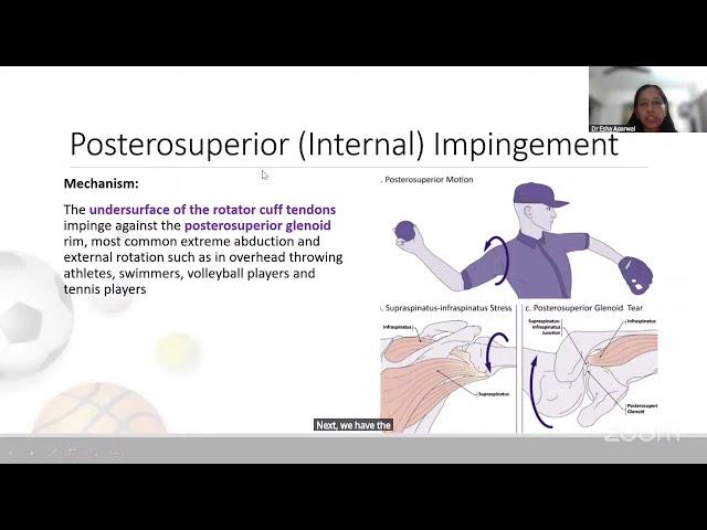 Radiology - Imaging in Sports Injuries