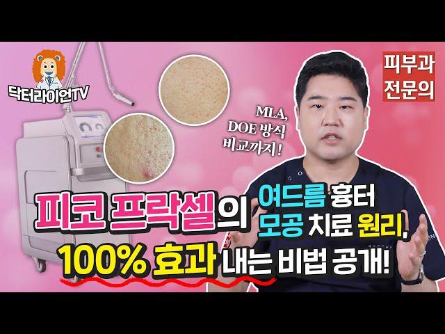 [여드름 흉터 정복 6탄] 피코 프락셀의 여드름 흉터·모공 치료 원리, 100% 효과 내는 비법 공개!