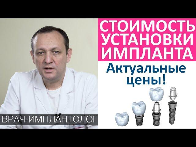 Сколько стоит установить зубной имплант. Цена имплантации.Из чего состоит стоимость зубного импланта