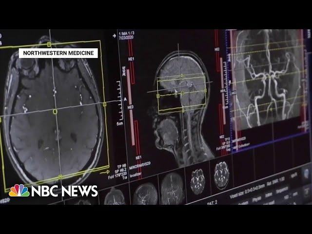 New findings offer more answers on long Covid