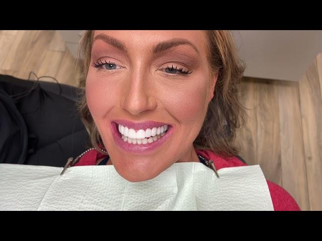 Houston Cosmetic Dentist....Want a Hollywood Smile without breaking the bank?? Watch this!