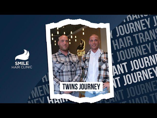 Double the Transformation: Twin Brothers’ Hair Transplant Journey | Joseph & Peter Smile Hair Clinic