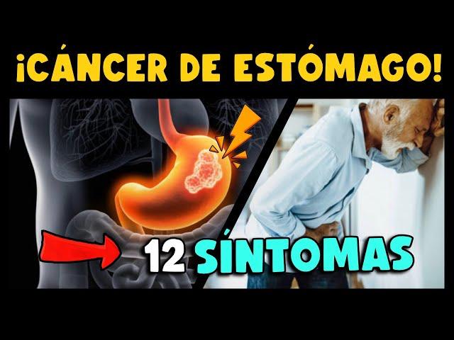 ¡CUIDADO! 12 SÍNTOMAS QUE REVELAN CÁNCER GÁSTRICO