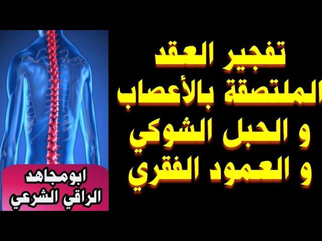 رقية قوية فك عقد ملتصقة بالأعصاب و النخاع الشوكي و العمود الفقري اتعبت و امرضت سنين عددا