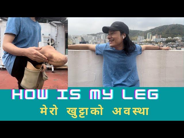 ME AND MY LEG  || #ARJUN TAMANG #GRACOMMANDO #4K QUALITY