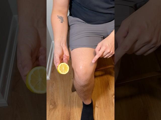 LEMON is the Best Natural Remedy for Joint Pain Here's Why! #painrelief  #homemaderecipe #lifehacks