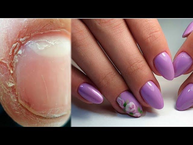 Huge Transformation On Stubby Nails / Snipping Off Cuticle With A Nail Drill 