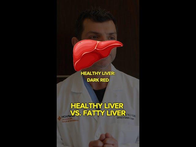 Healthy Liver VS. Fatty Liver