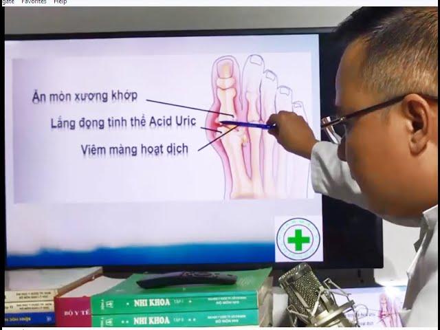 BỆNH GOUT VÀ CÁCH ĐIỀU TRỊ / Học bán thuốc Tây chuyên nghiệp. Lh 0934443949