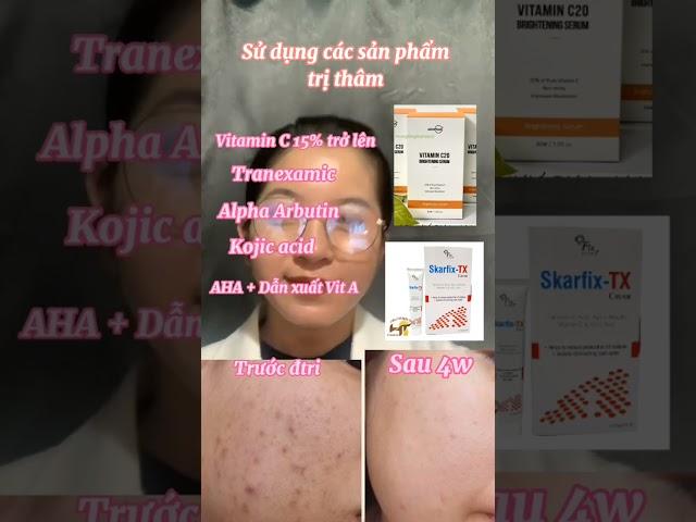 Cách điều trị thâm đỏ và thâm đen sau mụn hiệu quả   iLiving #shorts
