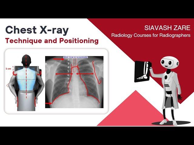 Chest X-ray (PA) Technique and Positioning