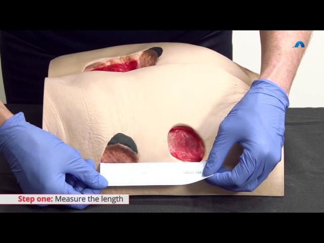 How to Measure a Wound | Measuring Wound Dimensions | Ausmed Education