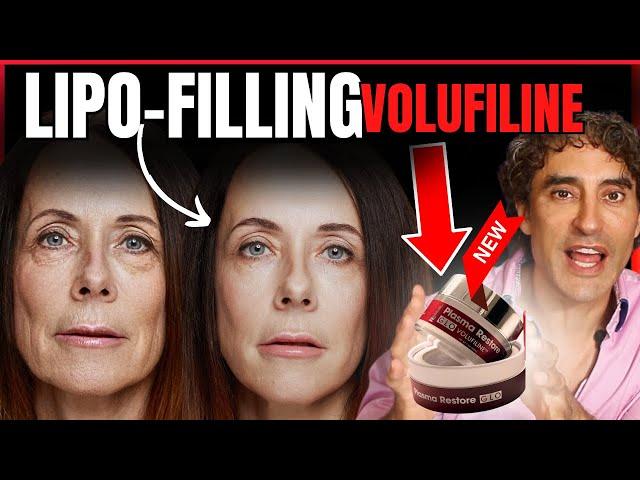 Volufiline Cream // Filler Without The Needles