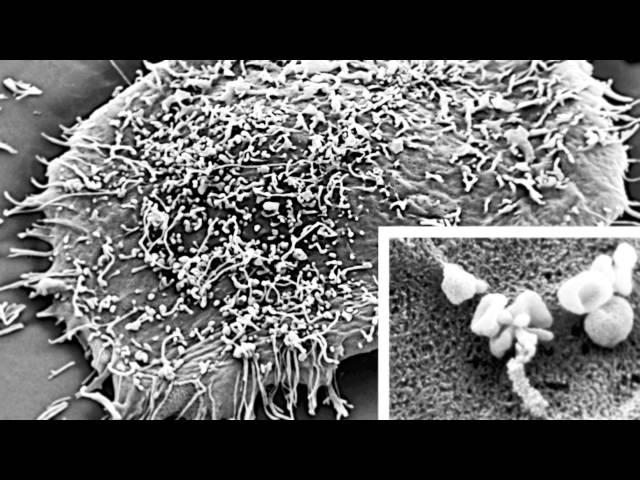 Better, Faster Cancer Diagnosis