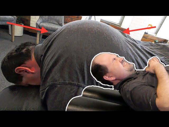 Man CAN'T Move His NECK & Has SEVERE HYPERKYPHOSIS! *Part 2*