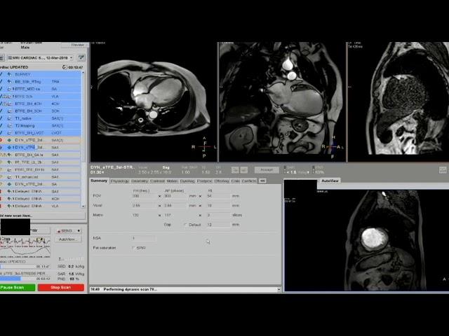 6. Live Scanning of CMR Dr  Pudhiavan