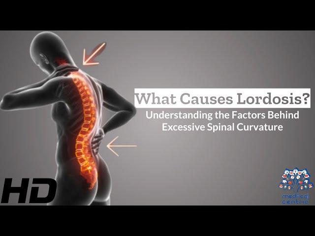 Unlocking Lordosis: The Factors Behind Excessive Spinal Curvature