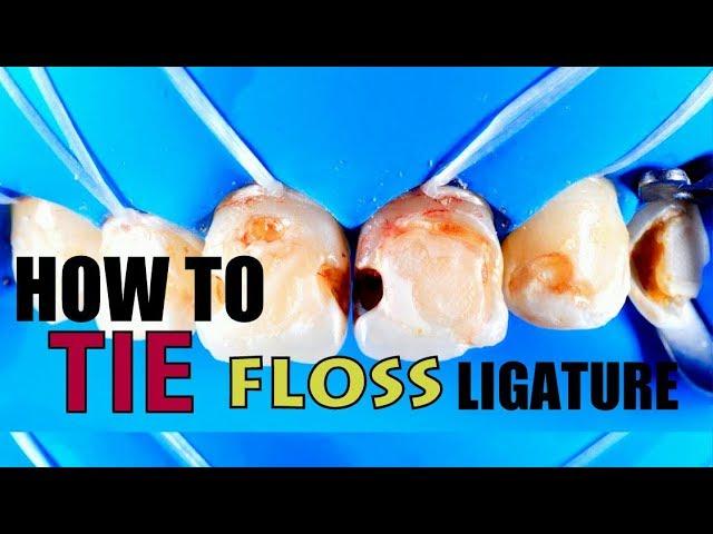 How to Tie Floss Ligature - DEMONSTRATION AND STEP BY STEP