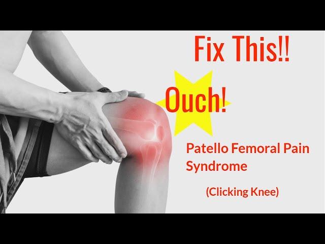 How to Fix Patellofemoral Pain Syndrome (Clicking Knee)