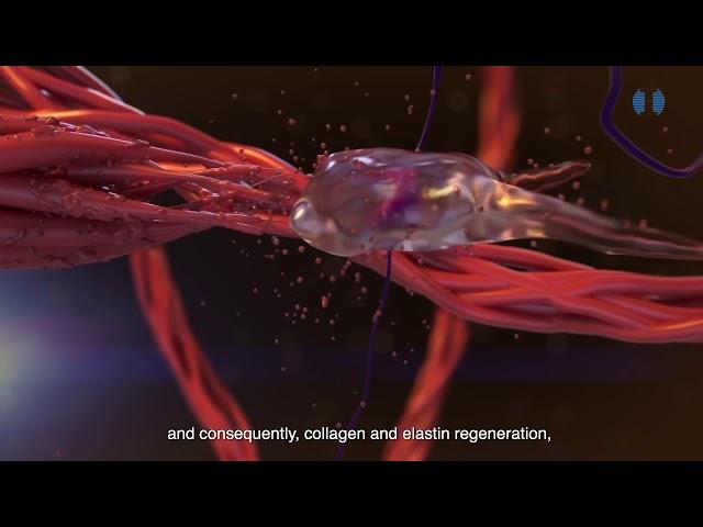 What goes on under the skin during an EnerJet treatment?