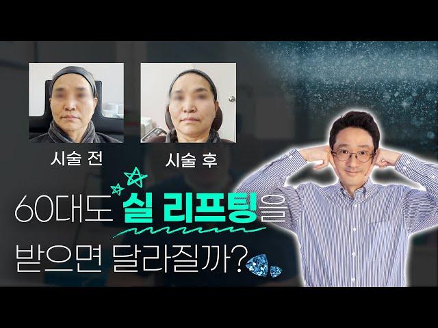 60대 여성분도 실 리프팅을 받으면 달라질까?  / 리필하는 남자 허선녕