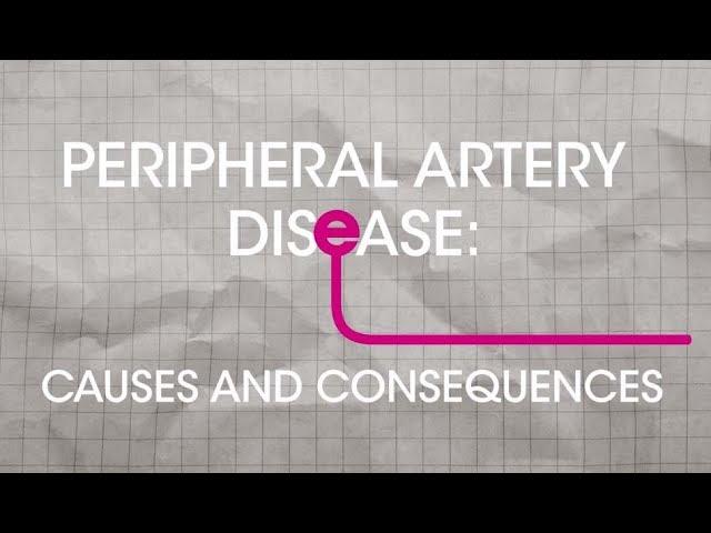 What is Peripheral Artery Disease (PAD): Causes and Consequences