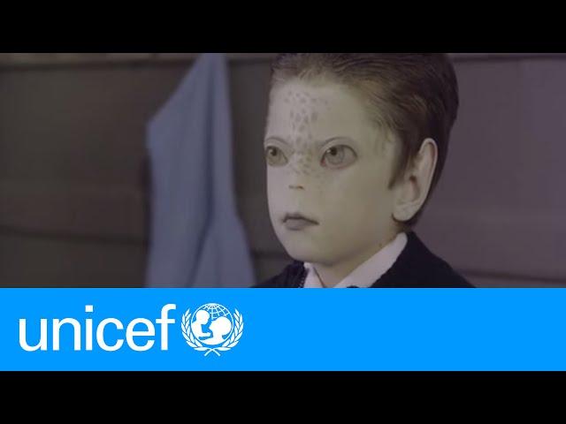 Marciano: An unexpected friend | UNICEF