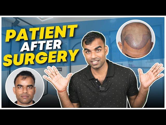 Hair Transplant in Ahmedabad | Best Results & Cost of Hair Transplant in Ahmedabad