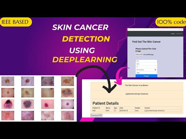 Skin Cancer Detection using Deep Learning | Machine learning | Best IEEE Machine Learning Project