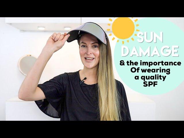 Sun Damage and the Importance of Wearing SPF | The Vanity Lab