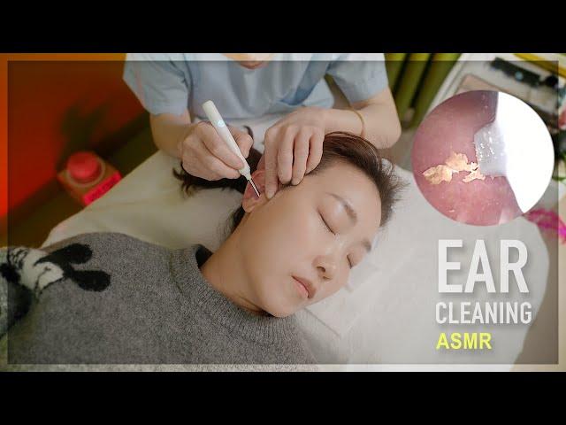 ASMR  Ear cleaning with camera  Deep sleep and relaxation