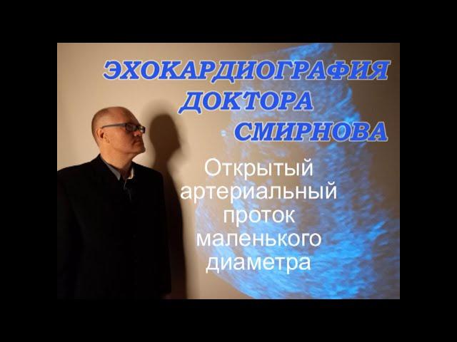 41. Открытый артериальный проток (ОАП)