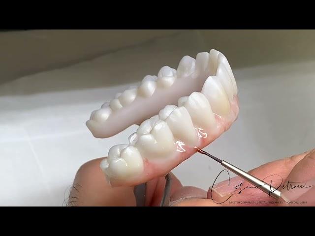 Implant Bridges Zirconia Monolithic Double Full Arch Tutorial