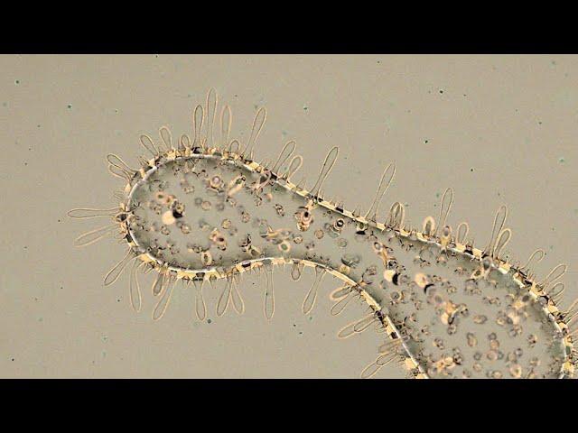 Microbes fighting. 3d animation.
