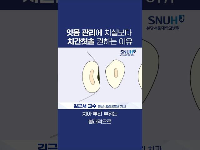 치과 교수가 치실보다 치간칫솔을 권하는 이유