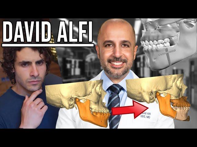 Jaw Surgery Matrix Download with Dr. David Alfi | JawCast #47