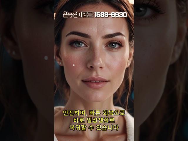 [실리프팅] 늦은 나이의 결혼식에 심부볼 고민이라면 실리프팅으로 해결! | #심부볼 #실리프팅 #실리프팅후기