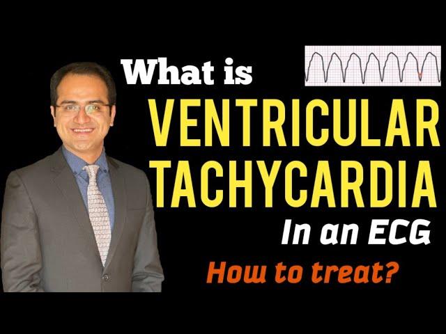 Ventricular Tachycardia (VT) ECG Interpretation, Treatment (ACLS Management), Lectures, USMLE, NCLEX