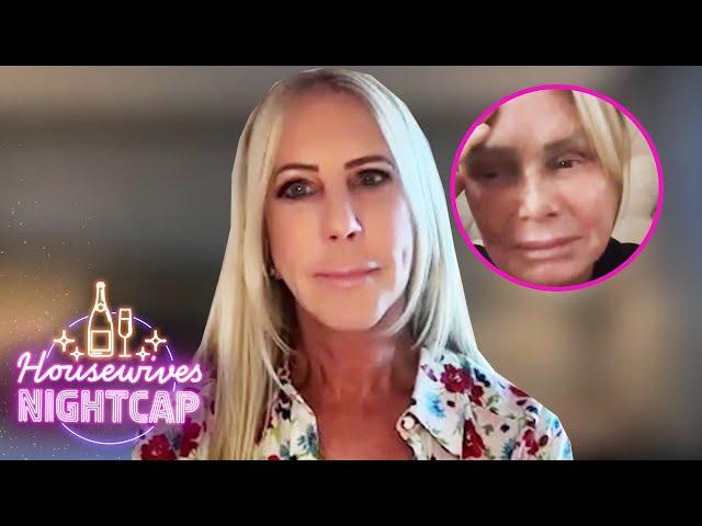 Vicki Gunvalson CALLS OUT Tamra Judge & Details Near Death Experience