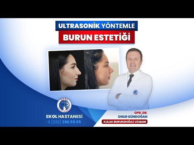 İzmir Ekol Hastanesi - Ultrasonik Yöntemle Burun Estetiği - Opr. Dr. Onur Gündoğdu